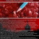 ОРУЖИЕ ГЕНОЦИДА,не завоюешь-проще ОТРАВИТЬ !!!